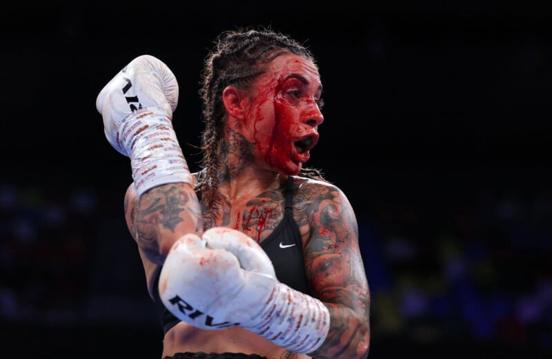 A female boxer with braided hair and tattoos, wearing white gloves and a black sports bra, is bleeding heavily from her face during a match. She looks to the side with her mouth open and one arm raised.